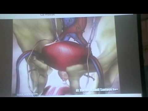 Perilaku seorang pria yang memiliki masalah dengan potensi Membeli potensi obat levitra levitra