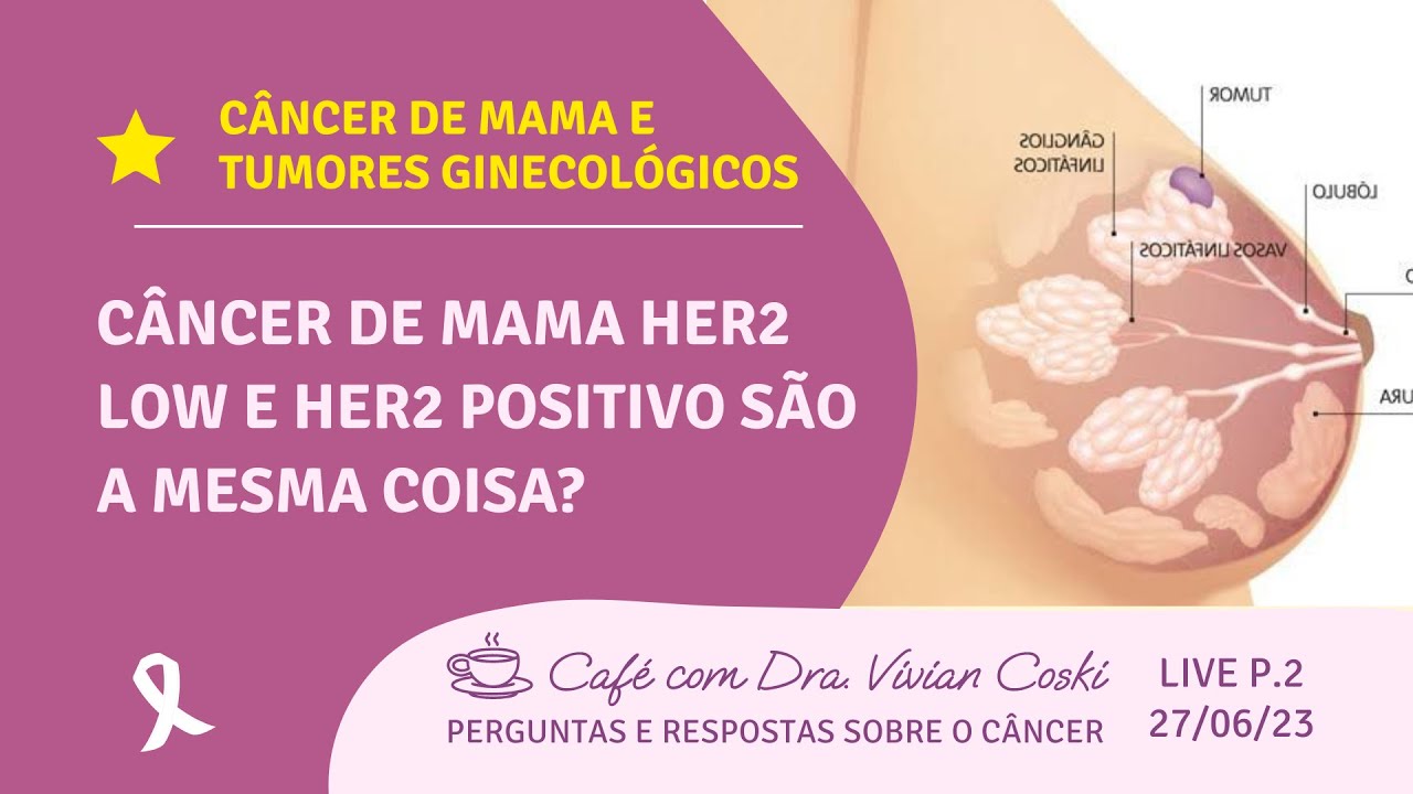 Câncer de mama HER2 low e HER2 positivo são a mesma coisa? Live 27/06/23, parte 2