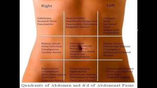 Differential diagnosis of abdominal pain according to abdominal regions