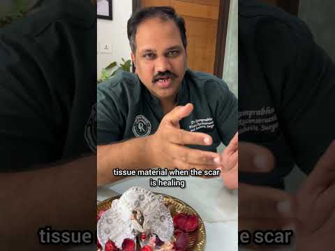 Keloid scar treatment explainer video by Dr. Ram Prabhu.