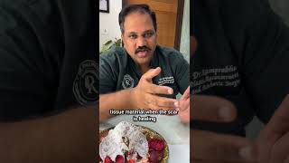 Scar Revision educational video thumbnail by Dr. Ram Prabhu