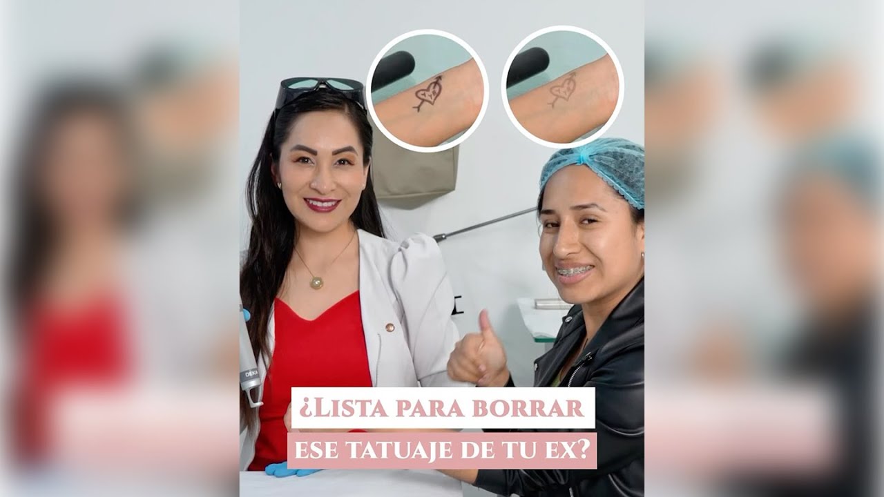 💔 ¿Estás lista para borrar ese TATUAJE de tu ex?⚡️ - Dra. Gisela Pilara Aire Farfán