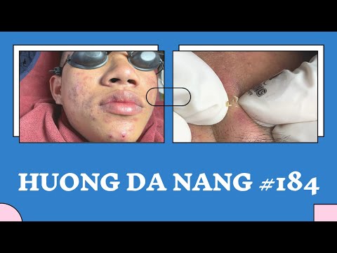 #184 | Huong Da Nang