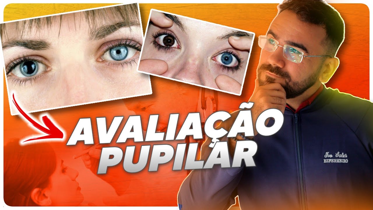 APRENDA A AVALIAR A PUPILA DA FORMA CERTA - AVALIAÇÃO PUPILAR