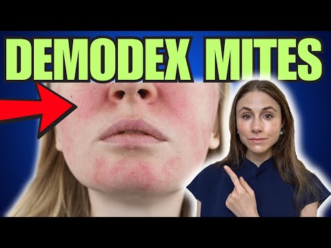 Demodex Mites: The Good, The Bad, & The Ugly