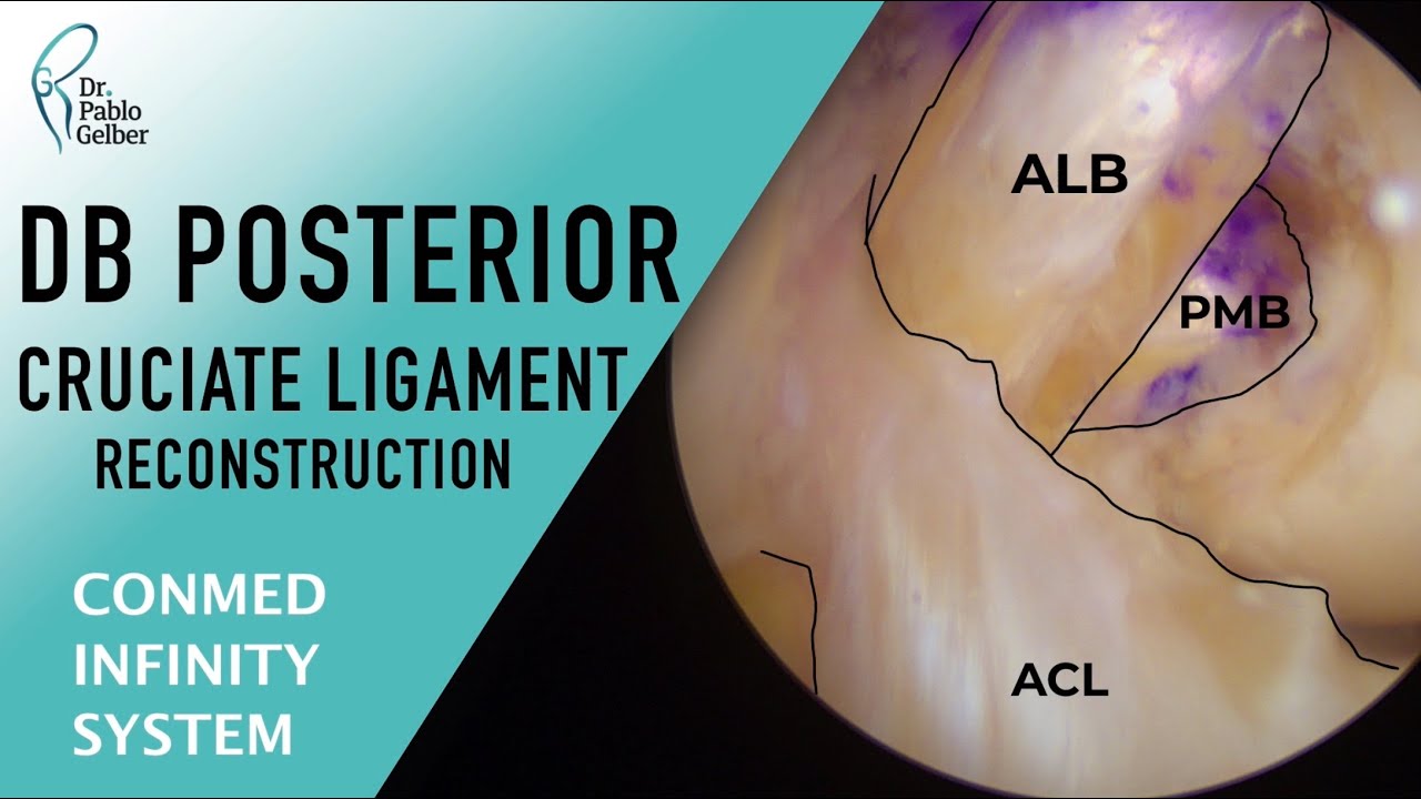 Pablo E. Gelber Ghertner-17