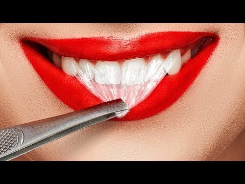download lagu mp3 mp4 Tips Cantik Gigi, download lagu Tips Cantik Gigi gratis, unduh video klip Tips Cantik Gigi