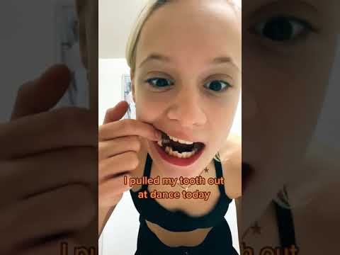 i pulled my tooth out! 🦷 #shorts