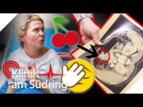 Der BLINDDARM soll raus! Diese Frau ISST absichtlich KIRSCHKERNE 🤦🏼 🍒 | Klinik am Südring | SAT.1