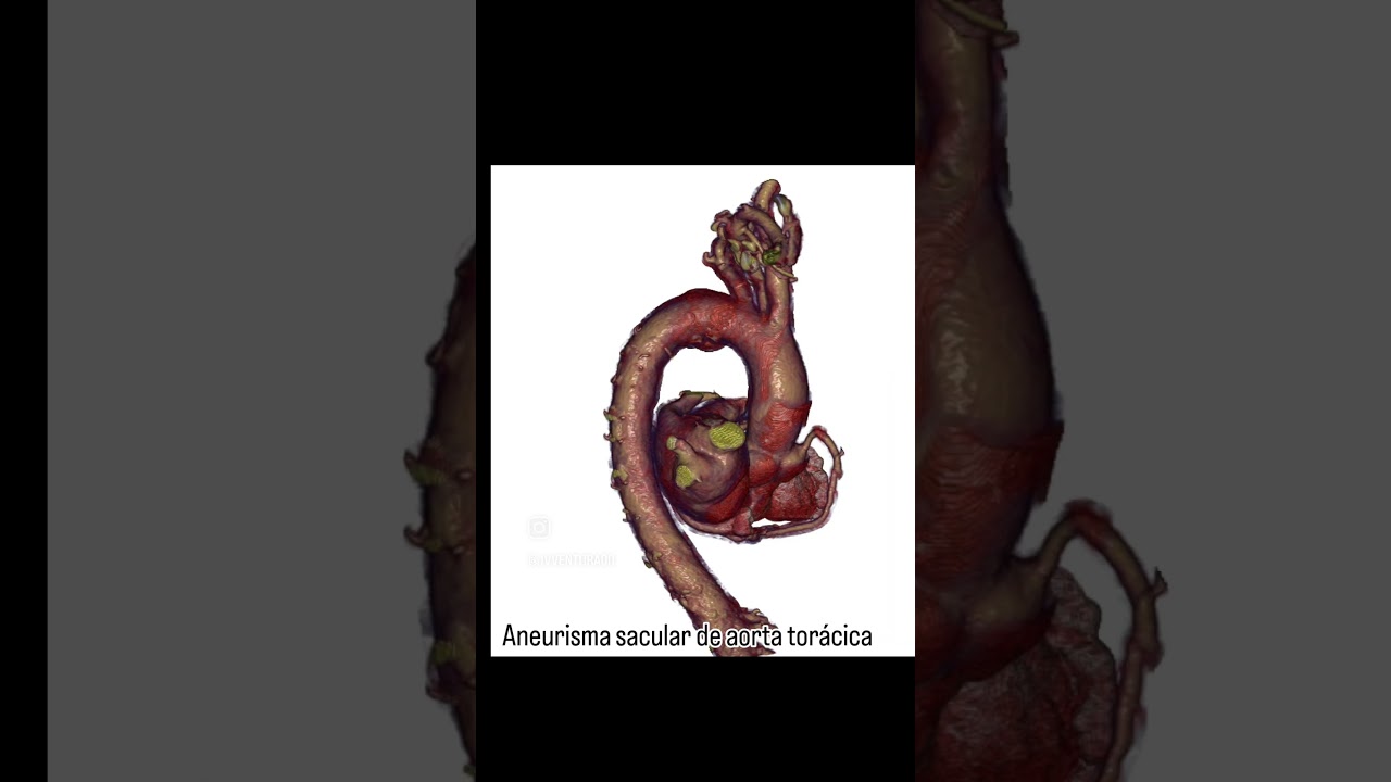 João Victor Ventura De Oliveira-6