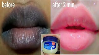 IN JUST 2 MINUTES TURN DARK LIPS TO PINK LIPS PERMANENTLY (RESULT IN LIVE DEMO)