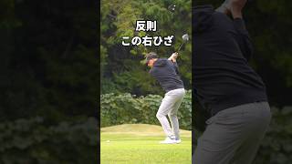 昔の右膝…ダサすぎた。でも今はこの形。ずっと待ってた。