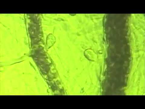 The BEMER Effect  –  Microscopic demonstration of the effect on microcirculation