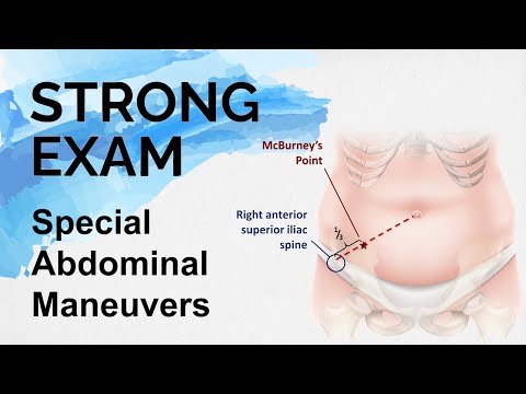 Special Abdominal Maneuvers (Strong Exam)