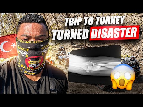 Disaster LEG BREAK in Turkey !
