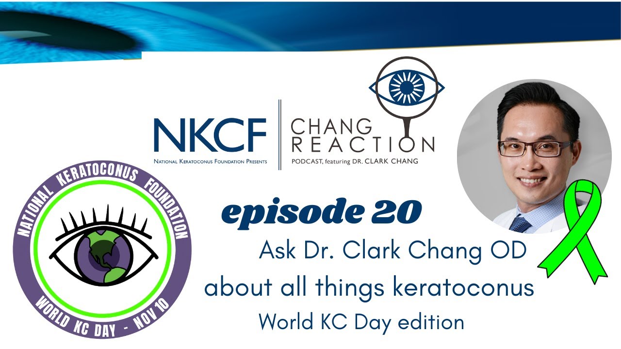 Chang Reaction Episode 20: Is it bad to skip days wearing my KC contact lenses? - World KC Day