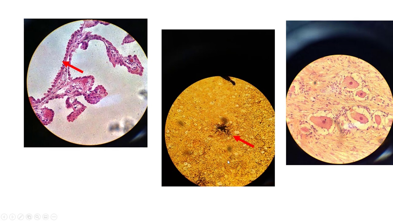 Nervous Tissue models, slides