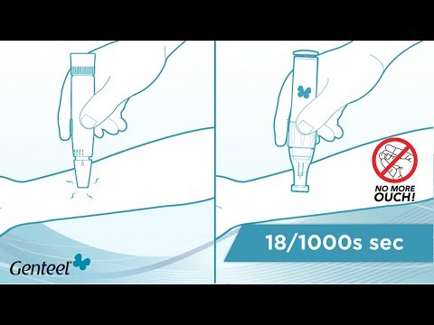 New Device for Pain-Free Glucose Testing Anywhere on Body - Video Series