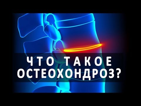 Как делают инъекции в сустав Алтай санаторий лечение суставов