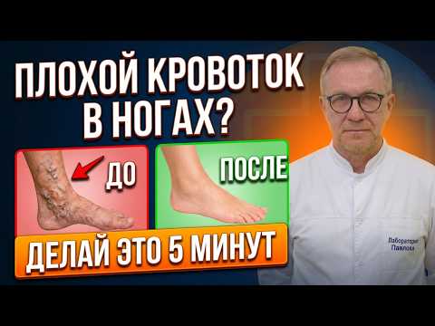Тест за 30 секунд покажет правду о венах (3 движения от тромов)
