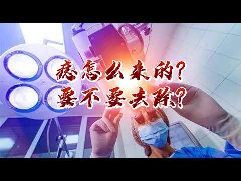 痣怎麼來的