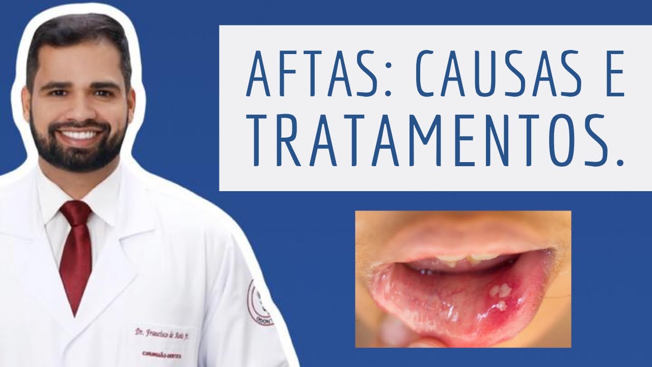 Francisco De Assis Almeida Lima Júnior-76