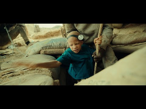 The Boy with White Skin