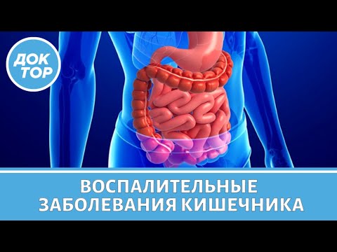 Симптомы воспалительных заболеваний кишечника