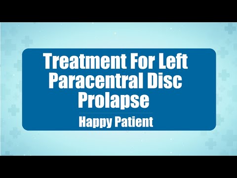 Disc Prolapse Treatment in Kakinada | Medicover Hospitals - Video Thumbnail