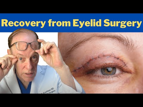 How to Recover from a Blepharoplasty | Plastic Surgeon's Guidance on Eyelid Surgery Recovery