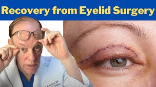 How to Recover from a Blepharoplasty | Plastic Surgeon