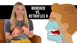 Bunched R vs. Retroflex R Tongue Placement by Peachie Speechie