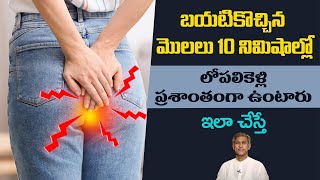 Home Remedies for Piles | Get Rid of Hemorrhoids | Pain Relief | Manthena