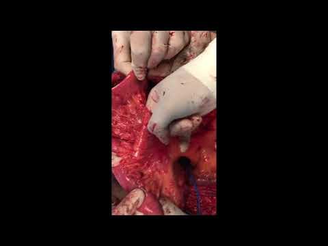 Surgical Oncology — Clinical Perspectives