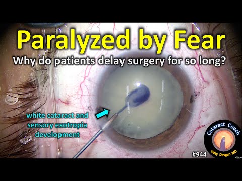 Why are some patients so afraid of cataract surgery?