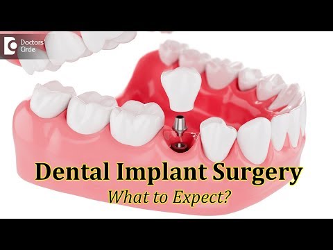 Are dental implants a surgical procedure? Treatment Steps- Dr. Deepa Jayashankar|Doctors' Circle