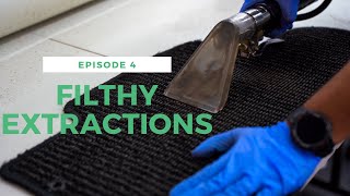 Simply EXTRACTIONS | FILTHY Deep Cleaning Compilation Ep4