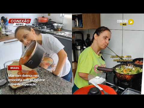 Vídeo: Mãe com doença rara emociona web ao mostrar rotina de superação.