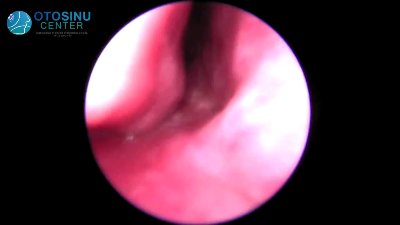 Walter Florez Guerra-14