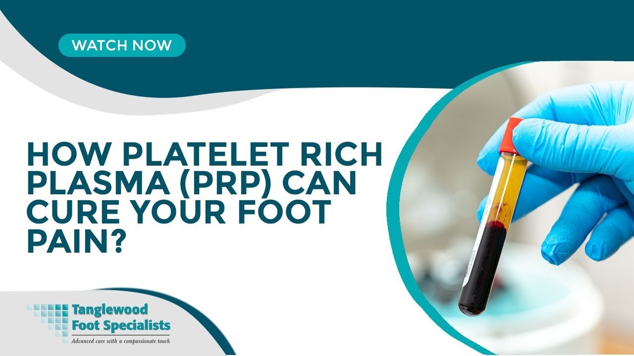 How Platelet Rich Plasma (PRP) Can Cure Your Foot Pain