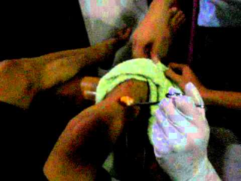 Paggamot katutubong lunas palad halamang-singaw Malyshevoy ng payo kung paano ituring ang kuko halamang-singaw