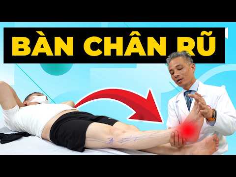 Bàn Chân Rũ Khi Đi Lại: Dấu Hiệu Tổn Thương Thần Kinh 90% Người Bỏ Qua!