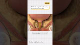 Download lagu Mengatasi Kencing yang tidak terkendali mp3