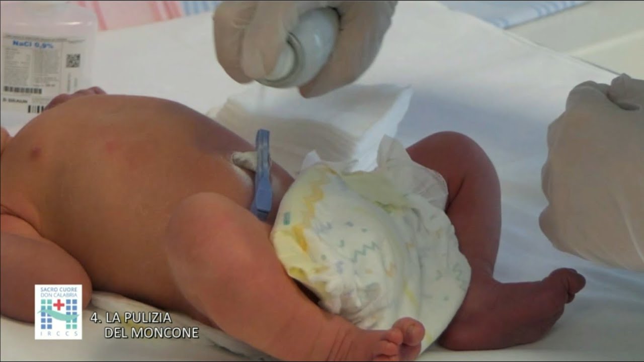 4. La pulizia del moncone