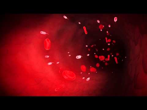 Deadly bacteria in Florida beaches, raw oysters can destroy your skin and kill you