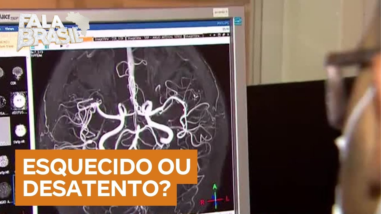 Esquecido ou desatento? Especialistas dão dicas para melhorar a memória