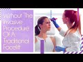 Experience the Ease of PDO Threading at N2U Aesthetics