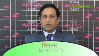 Symptoms And Treatment of Shingles in Hindi