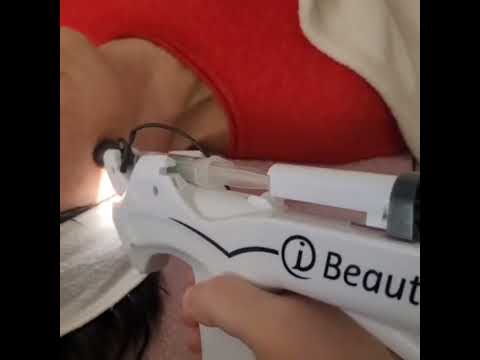 Mésothérapie sans aiguilles avec ampoule, peeling du visage et option à modelage kobido (jusqu'à 45% de remise) - Image 2