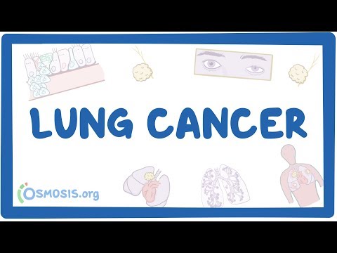 Cancer pulmonar non-small cell